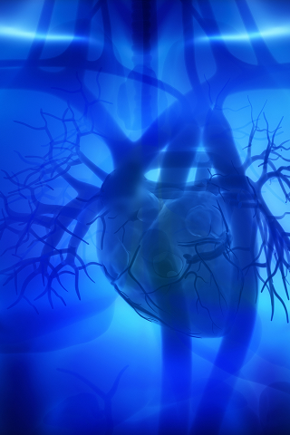 Amgen–Herz Röntgenbild